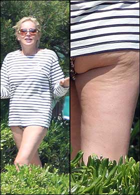 cellulite-sharon-stone