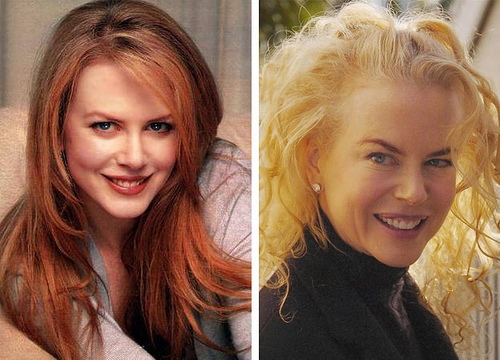 nicole-kidman-prime-e-dopo