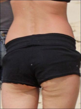 cellulite-kate-moss