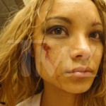 La cantante Tila Tequila aggredita durante un concerto